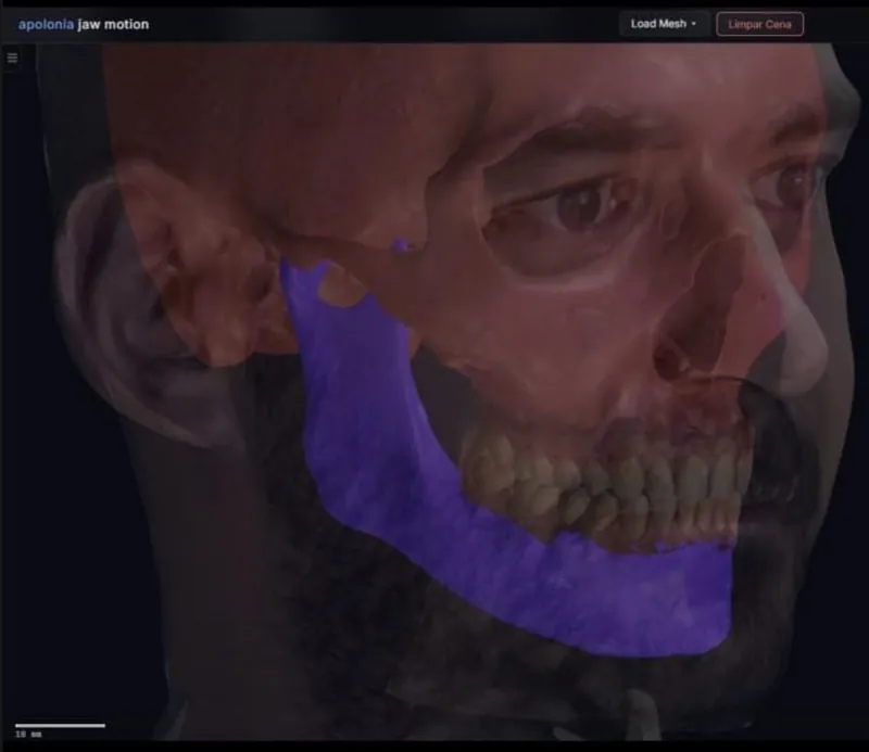 Plataforma Apolonia Jaw Motion mostrando a mandíbula em 3D sobreposta ao rosto do paciente